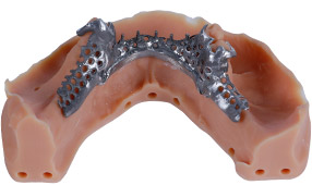 Dental wax type